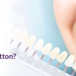 Are You Looking for Teeth Whitening in Sutton